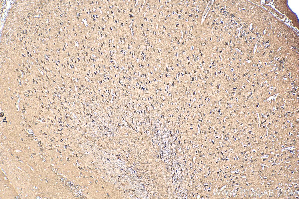 Immunohistochemistry (IHC) staining of mouse brain tissue using ACCN5 Polyclonal antibody (25356-1-AP)