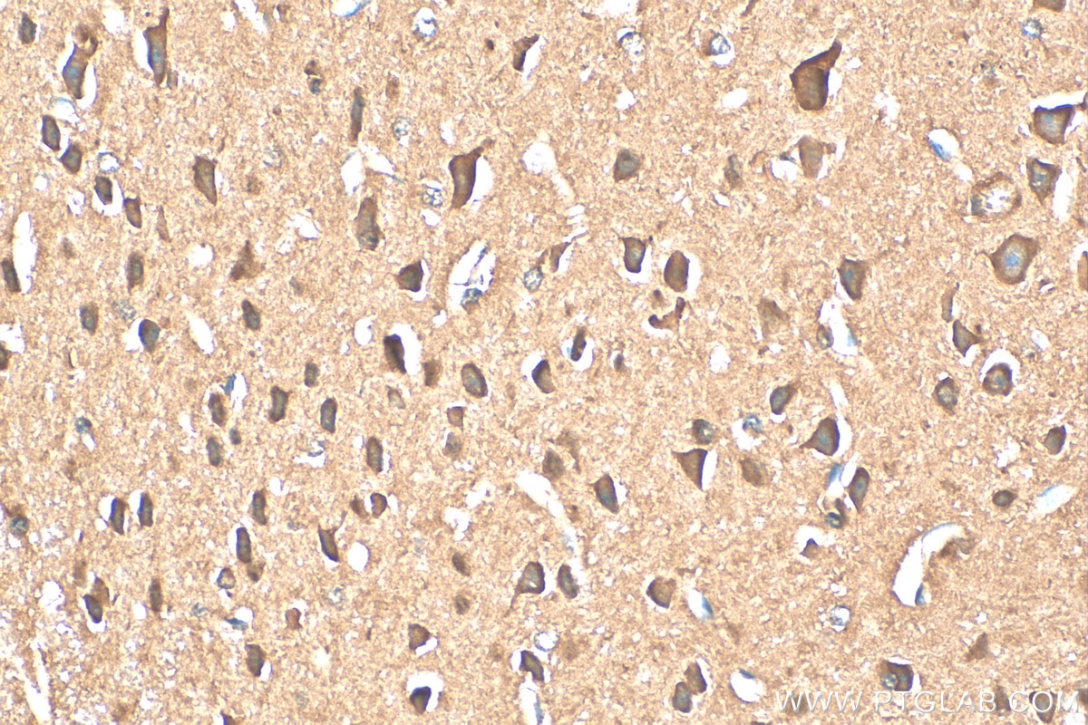 Immunohistochemistry (IHC) staining of mouse brain tissue using ACCN5 Polyclonal antibody (25356-1-AP)