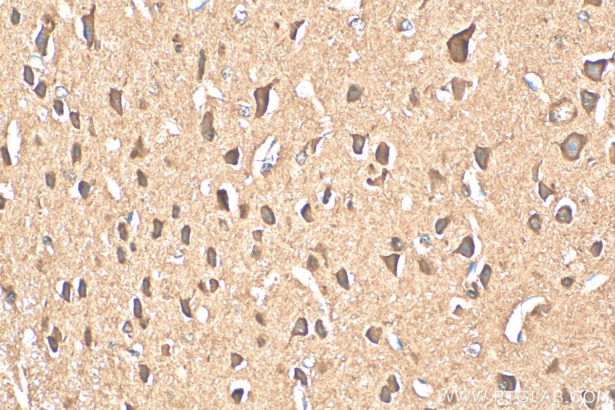 Immunohistochemistry (IHC) staining of mouse brain tissue using ACCN5 Polyclonal antibody (25356-1-AP)