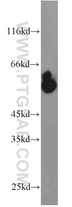 Western Blot (WB) analysis of mouse testis tissue using PHACS Polyclonal antibody (11491-1-AP)