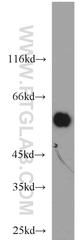 Western Blot (WB) analysis of MDA-MB-453s cells using PHACS Polyclonal antibody (11491-1-AP)