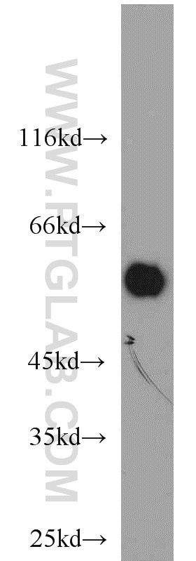 WB analysis of MDA-MB-453s using 11491-1-AP