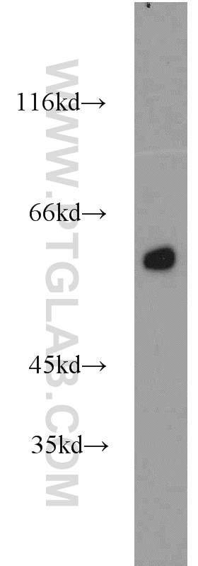 Western Blot (WB) analysis of mouse testis tissue using PHACS Polyclonal antibody (11491-1-AP)