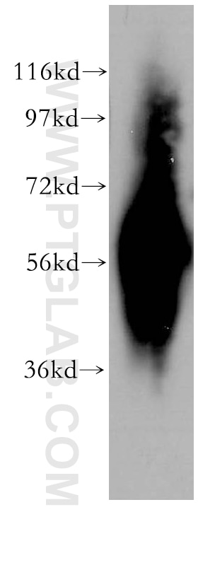 Western Blot (WB) analysis of HeLa cells using PHACS Polyclonal antibody (11491-1-AP)