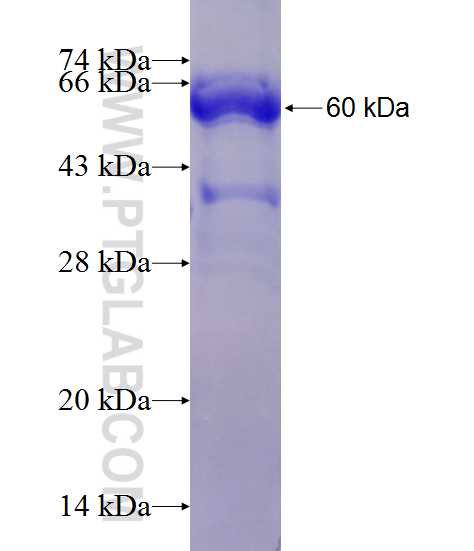 ACCS fusion protein Ag2056 SDS-PAGE