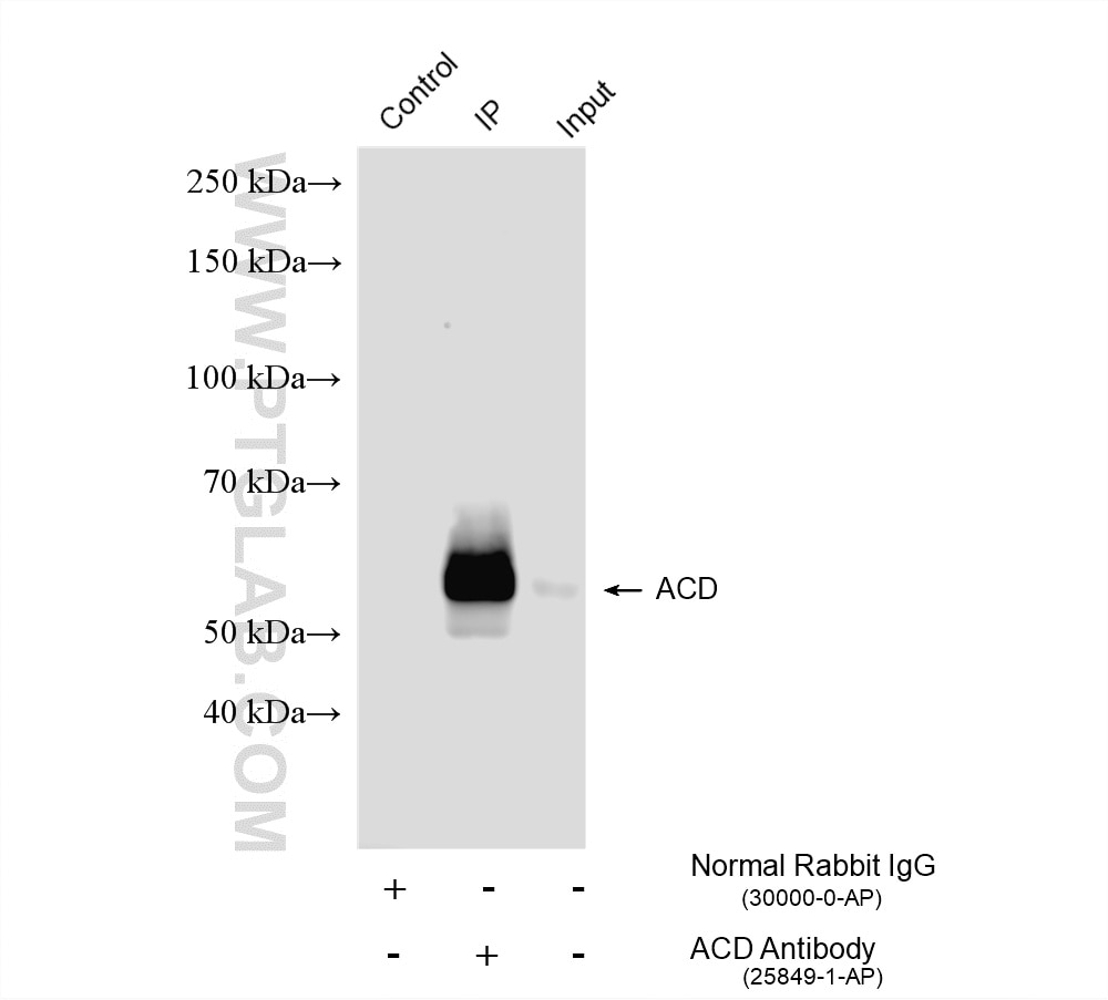 Immunoprecipitation (IP) experiment of Jurkat cells using ACD Polyclonal antibody (25849-1-AP)