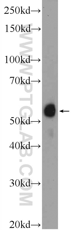 Western Blot (WB) analysis of Jurkat cells using ACD Polyclonal antibody (25849-1-AP)