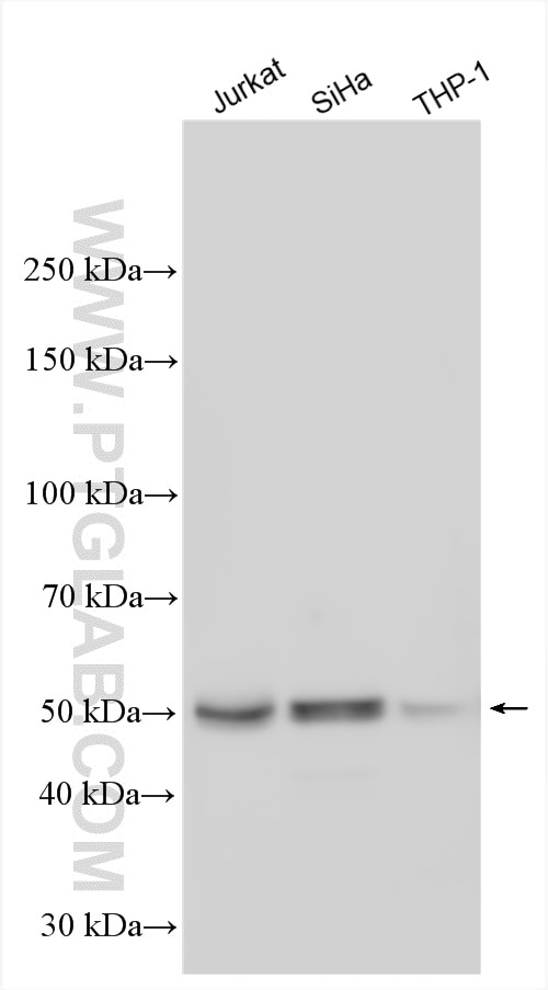 WB analysis using 25849-1-AP Western Blot (WB) analysis of various lysates using ACD Polyclonal antibody (25849-1-AP)