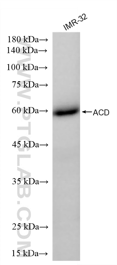 WB analysis of IMR-32 using 88168-3-RR (same clone as 88168-3-PBS) Western Blot (WB) analysis of IMR-32 cells using ACD Recombinant monoclonal antibody (88168-3-RR)
