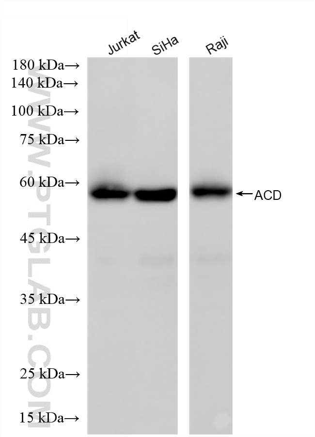 WB analysis using 88168-3-RR (same clone as 88168-3-PBS) Western Blot (WB) analysis of various lysates using ACD Recombinant monoclonal antibody (88168-3-RR)
