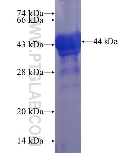 ACD fusion protein Ag22523 SDS-PAGE