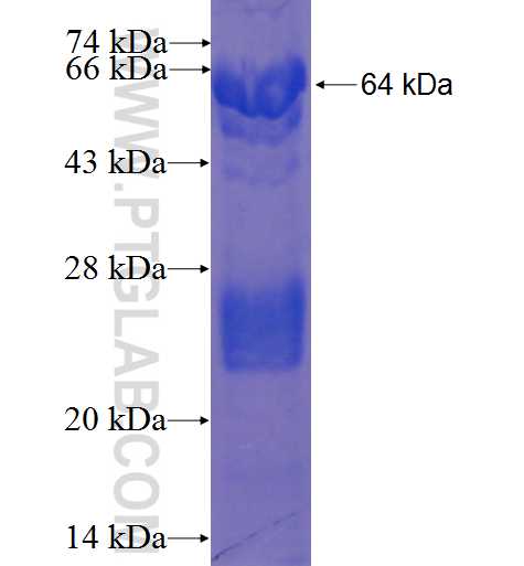 ACD fusion protein Ag23021 SDS-PAGE