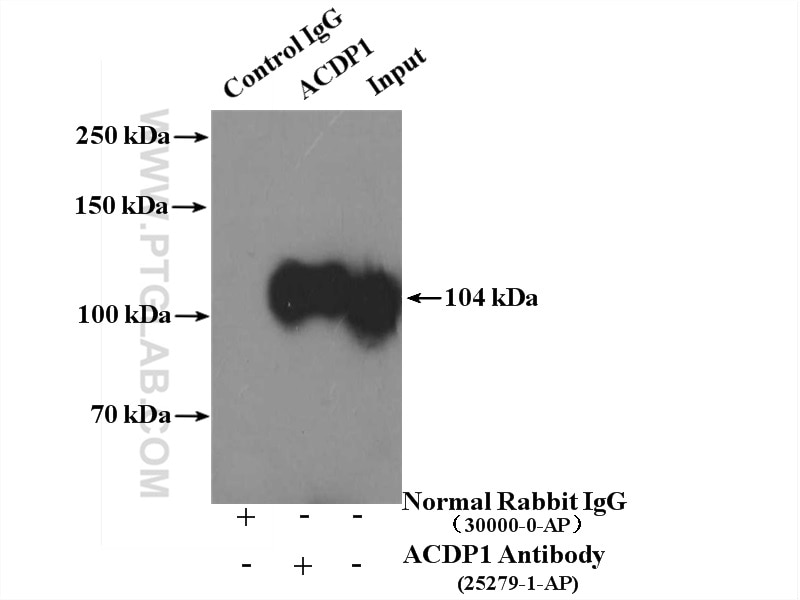 Immunoprecipitation (IP) experiment of mouse brain tissue using ACDP1 Polyclonal antibody (25279-1-AP)