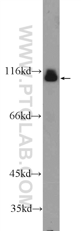 Western Blot (WB) analysis of mouse brain tissue using ACDP1 Polyclonal antibody (25279-1-AP)