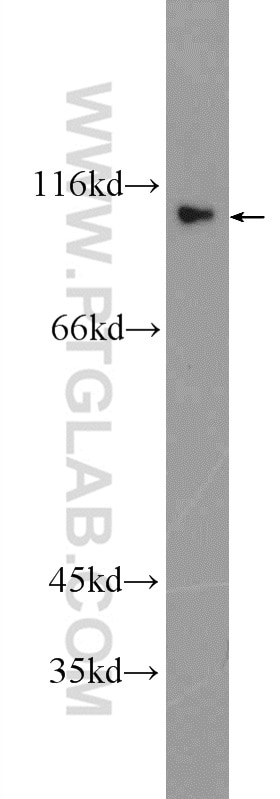 Western Blot (WB) analysis of rat brain tissue using ACDP1 Polyclonal antibody (25279-1-AP)