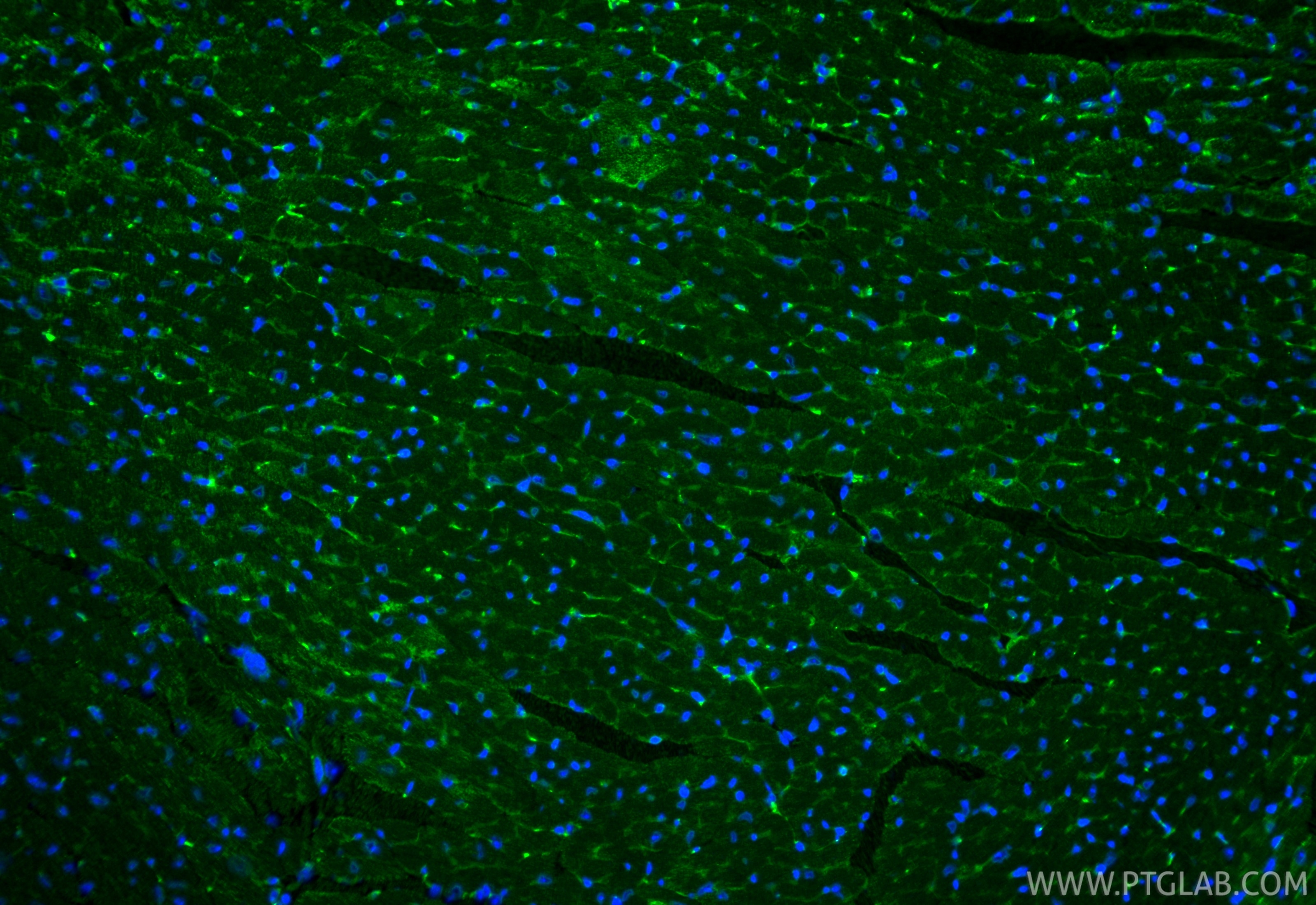 IF Staining of mouse heart using 24743-1-AP Immunofluorescence (IF) / fluorescent staining of mouse heart tissue using ACE Polyclonal antibody (24743-1-AP)