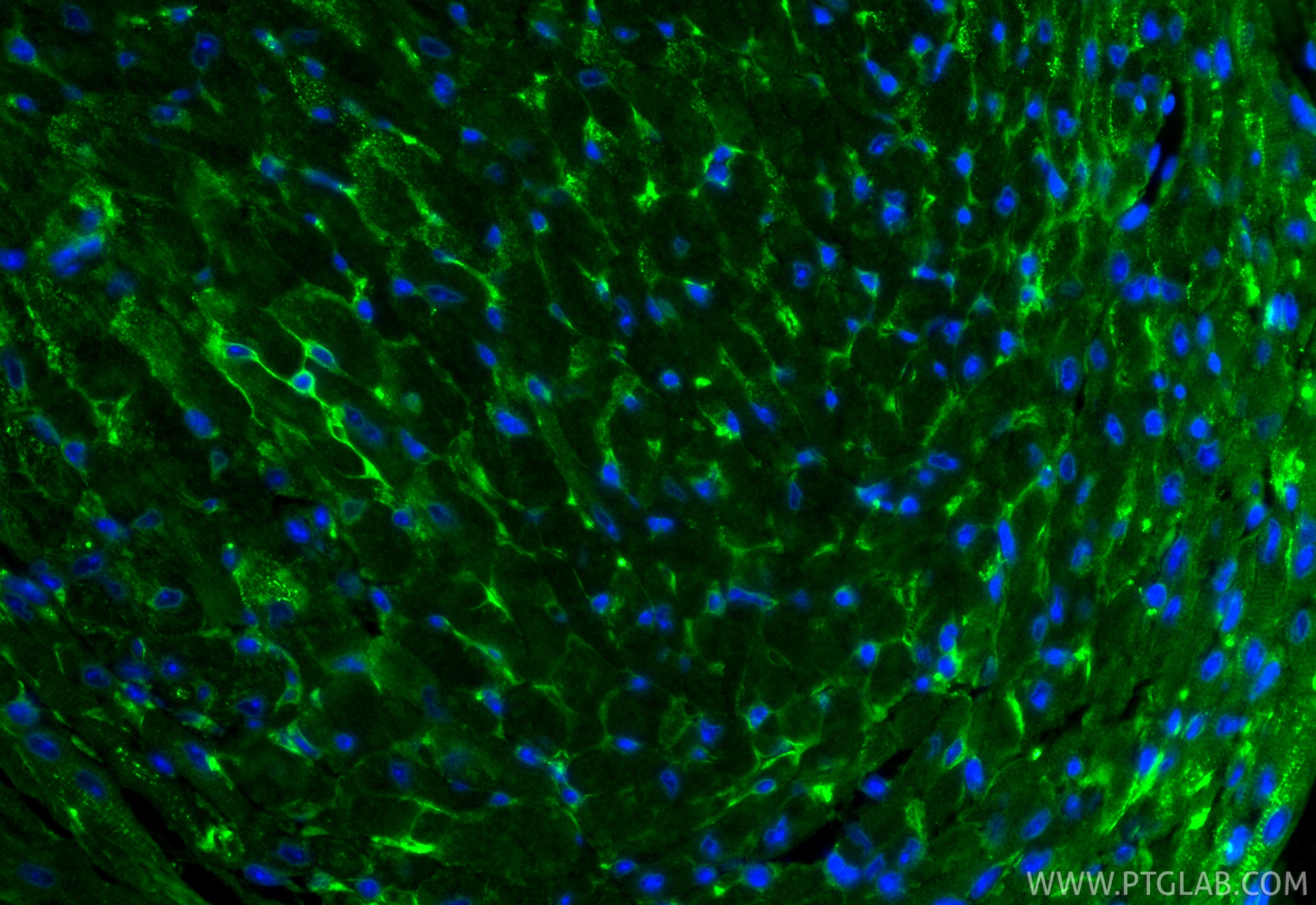 IF Staining of mouse heart using 24743-1-AP Immunofluorescence (IF) / fluorescent staining of mouse heart tissue using ACE Polyclonal antibody (24743-1-AP)