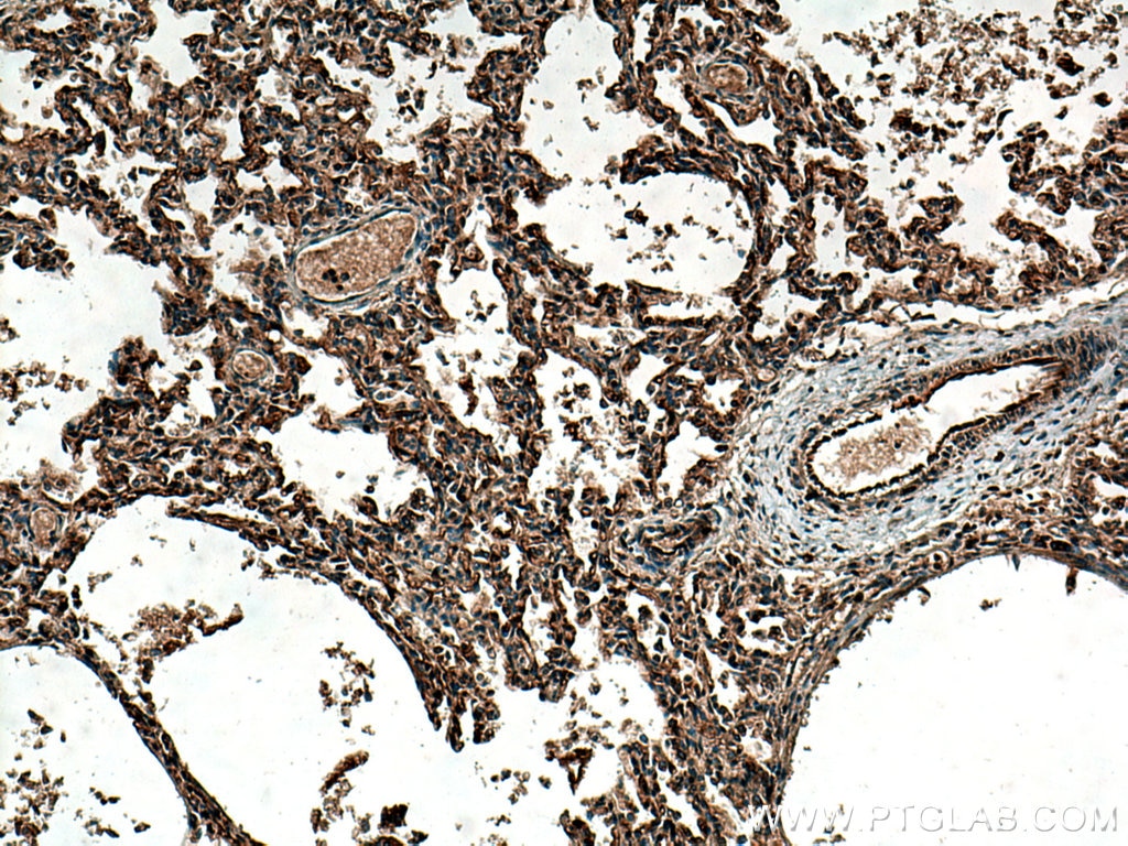 IHC staining of human lung using 24743-1-AP