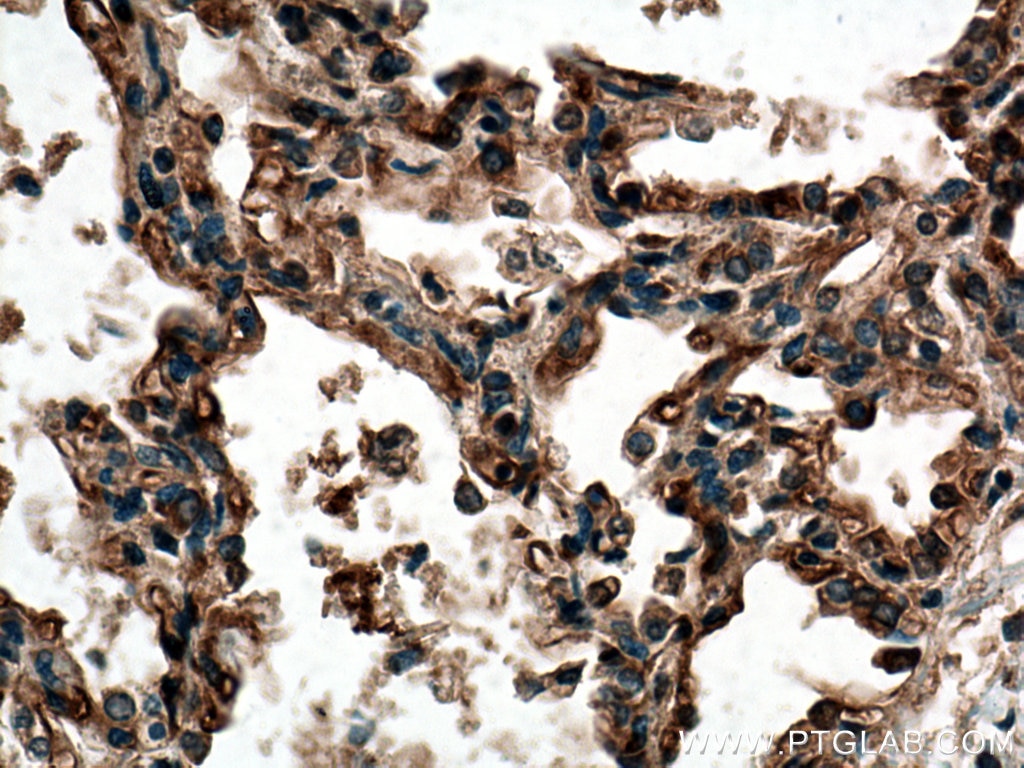 IHC staining of human lung using 24743-1-AP