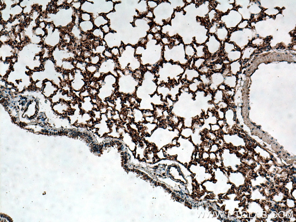 Immunohistochemistry (IHC) staining of mouse lung tissue using ACE Polyclonal antibody (24743-1-AP)