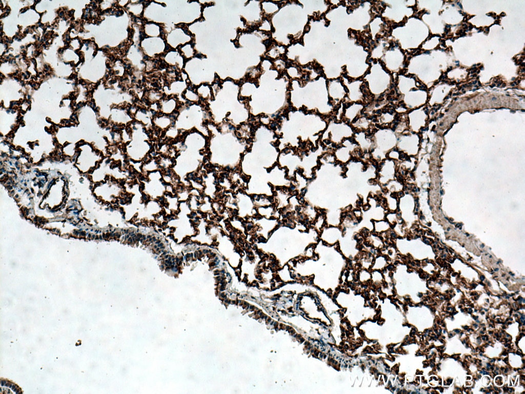 IHC staining of mouse lung using 24743-1-AP