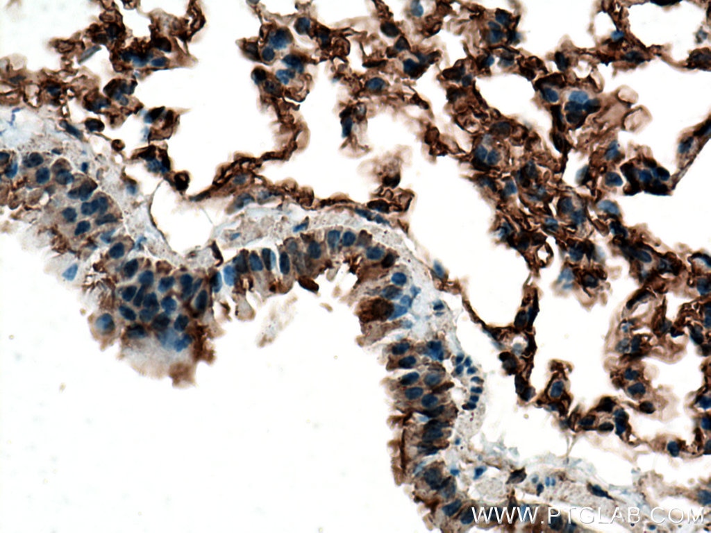 Immunohistochemistry (IHC) staining of mouse lung tissue using ACE Polyclonal antibody (24743-1-AP)
