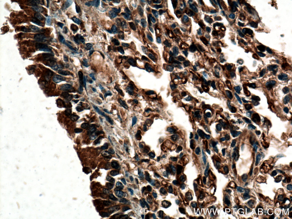Immunohistochemistry (IHC) staining of human lung tissue using ACE Polyclonal antibody (24743-1-AP)