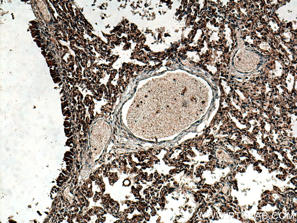 IHC staining of human lung using 24743-1-AP