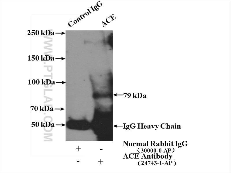 Immunoprecipitation (IP) experiment of mouse heart tissue using ACE Polyclonal antibody (24743-1-AP)
