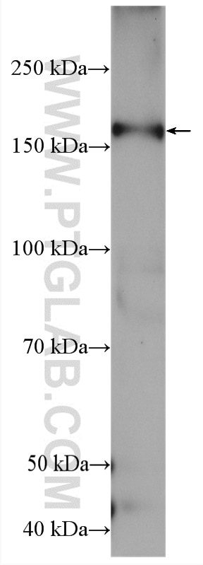 Western Blot (WB) analysis of rat lung tissue using ACE Polyclonal antibody (24743-1-AP)