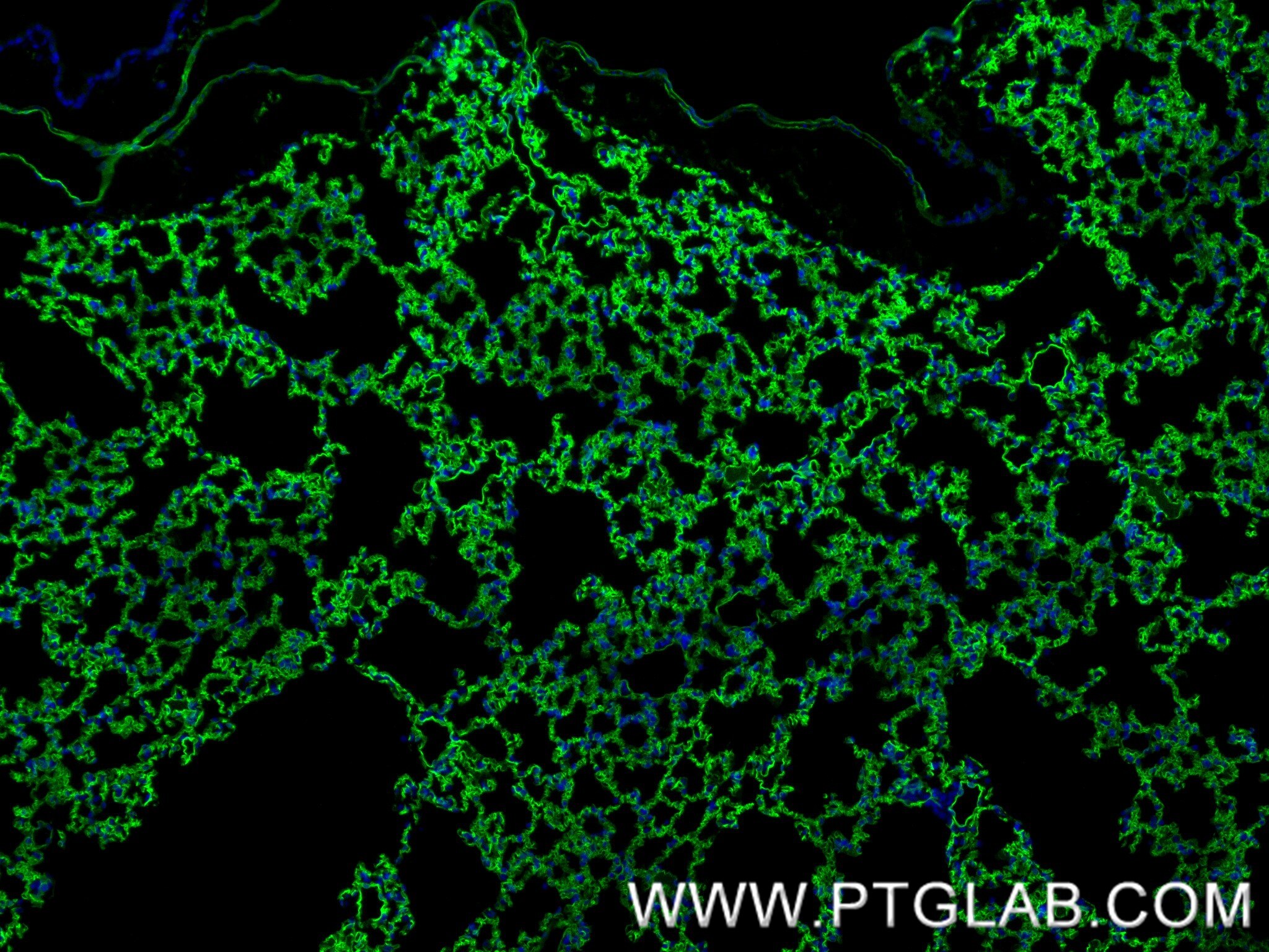 Immunofluorescence (IF) / fluorescent staining of mouse lung tissue using ACE Recombinant antibody (84407-4-RR)