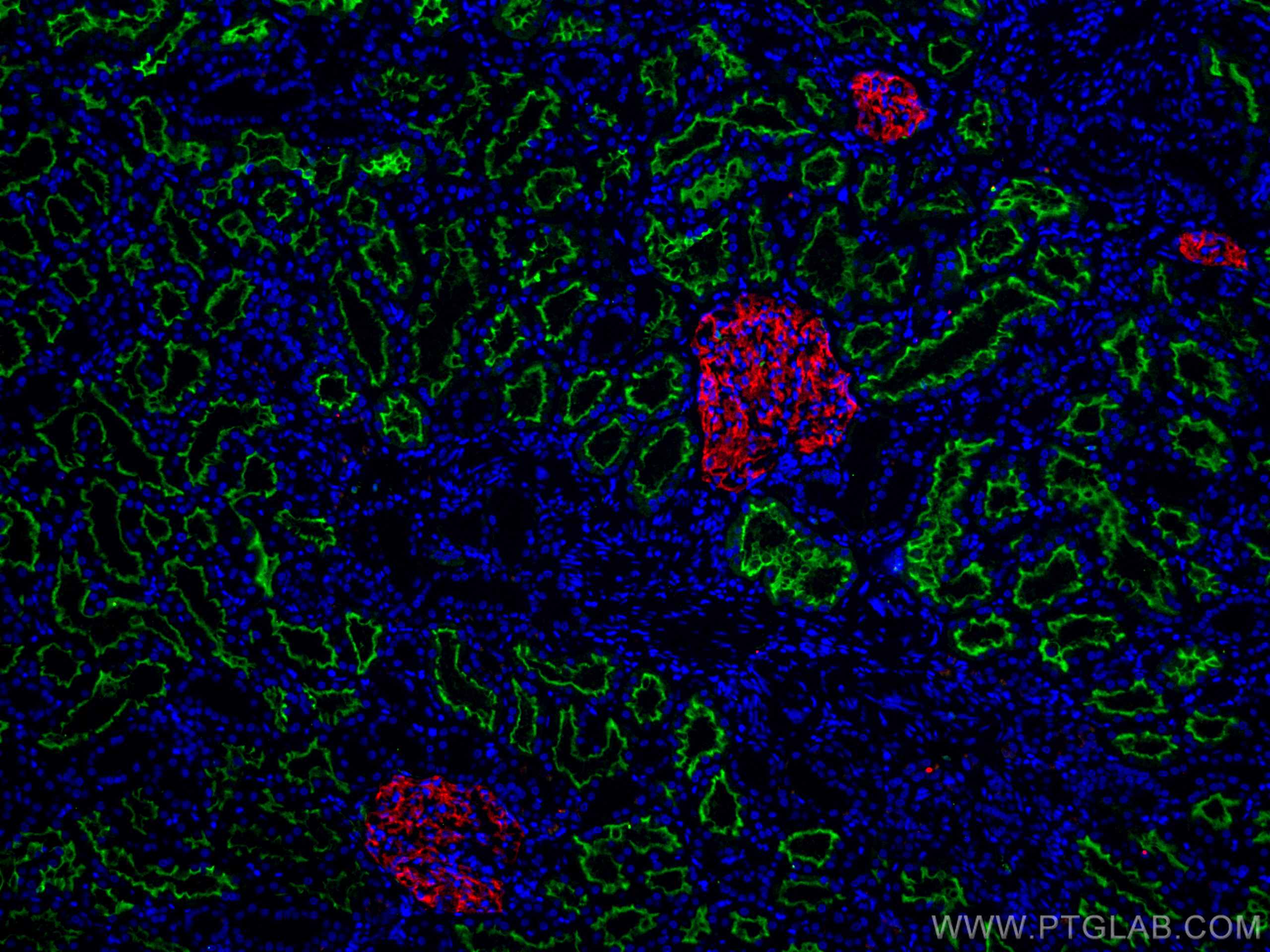 Immunofluorescence (IF) / fluorescent staining of human kidney tissue using ACE2 Polyclonal antibody (21115-1-AP)