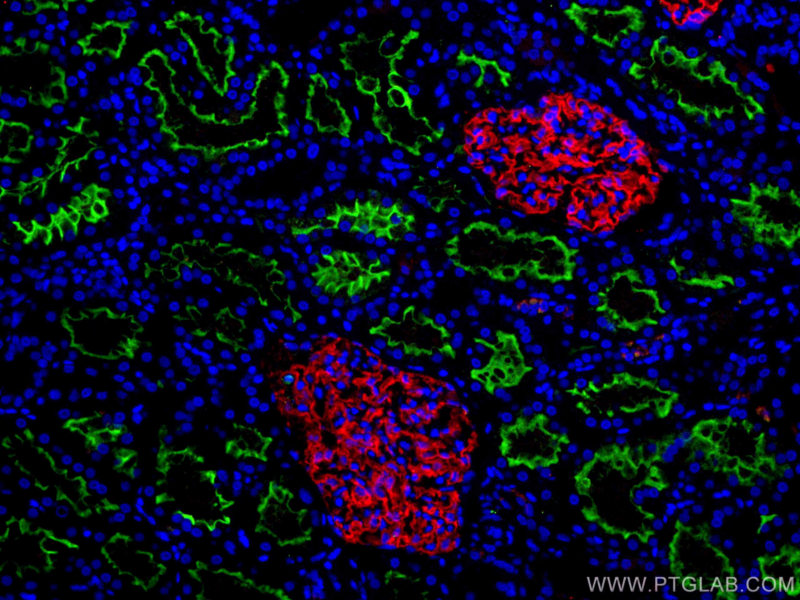 Immunofluorescence (IF) / fluorescent staining of human kidney tissue using ACE2 Polyclonal antibody (21115-1-AP)