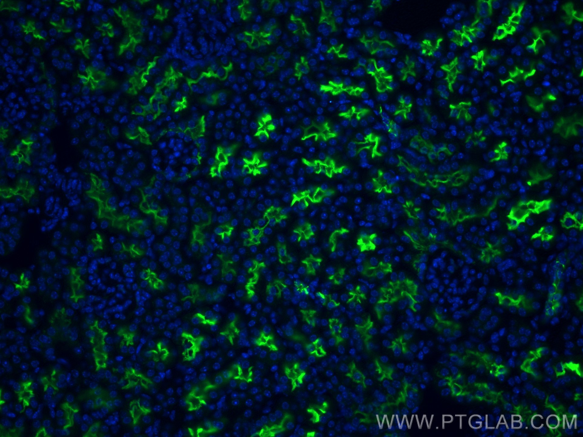 Immunofluorescence (IF) / fluorescent staining of mouse kidney tissue using ACE2 Polyclonal antibody (21115-1-AP)