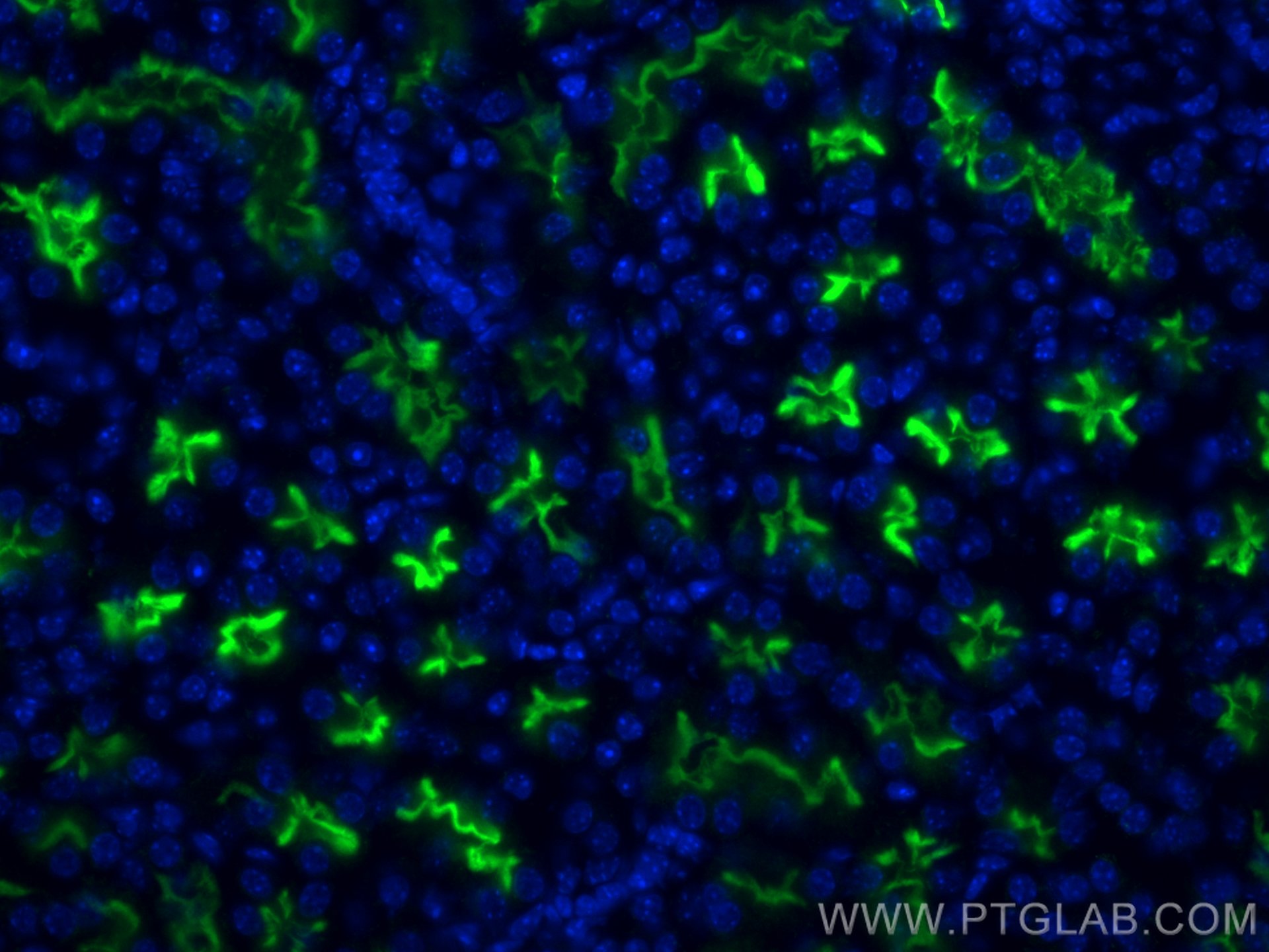 Immunofluorescence (IF) / fluorescent staining of mouse kidney tissue using ACE2 Polyclonal antibody (21115-1-AP)