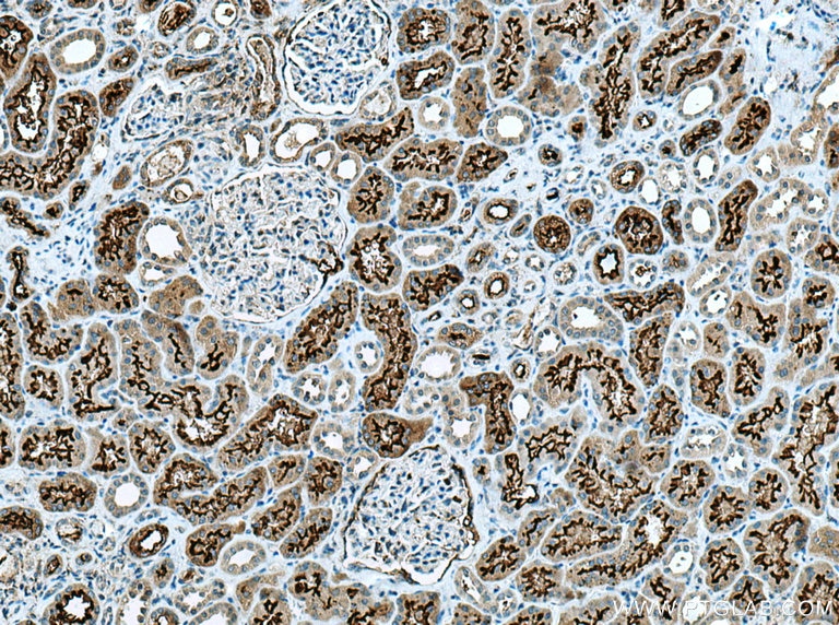 IHC staining of human kidney using 21115-1-AP