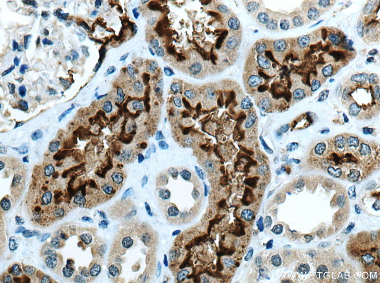 IHC staining of human kidney using 21115-1-AP