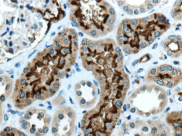 Immunohistochemistry (IHC) staining of human kidney tissue using ACE2 Polyclonal antibody (21115-1-AP)