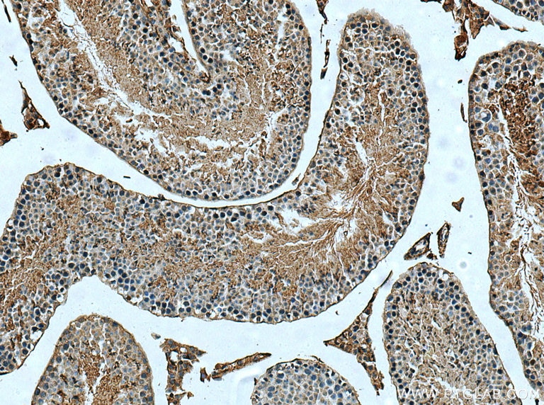 Immunohistochemistry (IHC) staining of mouse testis tissue using ACE2 Polyclonal antibody (21115-1-AP)