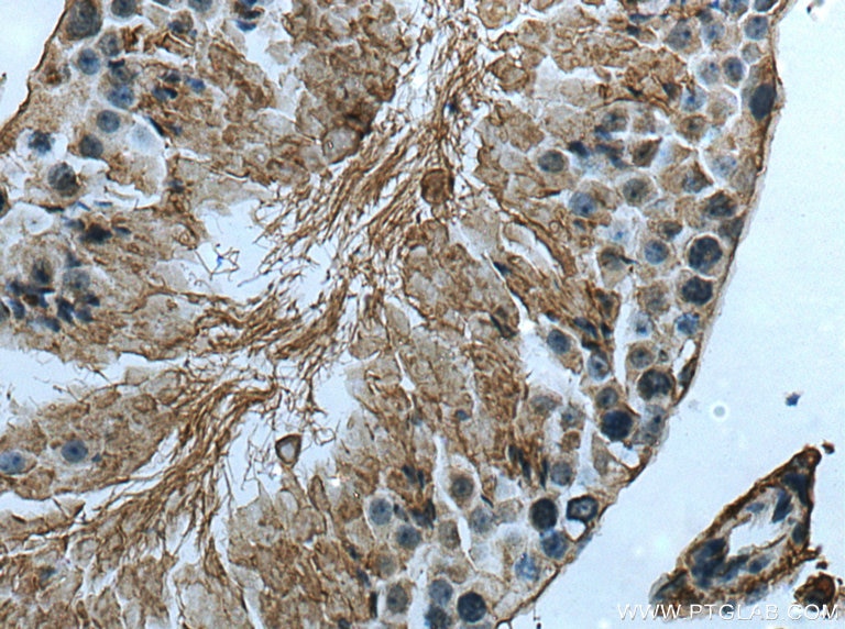 Immunohistochemistry (IHC) staining of mouse testis tissue using ACE2 Polyclonal antibody (21115-1-AP)