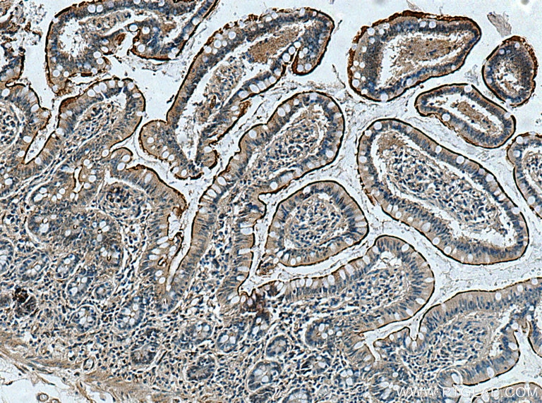 Immunohistochemistry (IHC) staining of human small intestine tissue using ACE2 Polyclonal antibody (21115-1-AP)