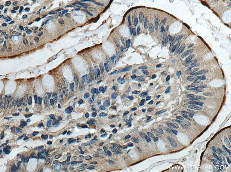 Immunohistochemistry (IHC) staining of human small intestine tissue using ACE2 Polyclonal antibody (21115-1-AP)