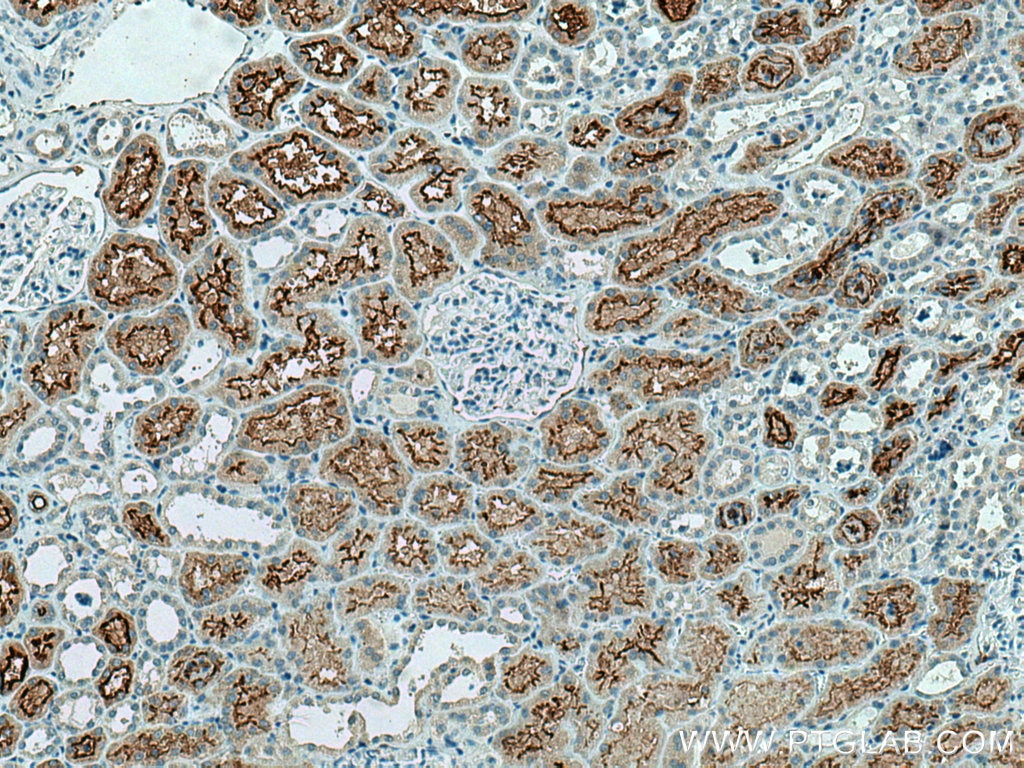 Immunohistochemistry (IHC) staining of human kidney tissue using ACE2 Polyclonal antibody (21115-1-AP)