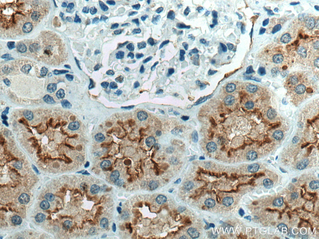Immunohistochemistry (IHC) staining of human kidney tissue using ACE2 Polyclonal antibody (21115-1-AP)