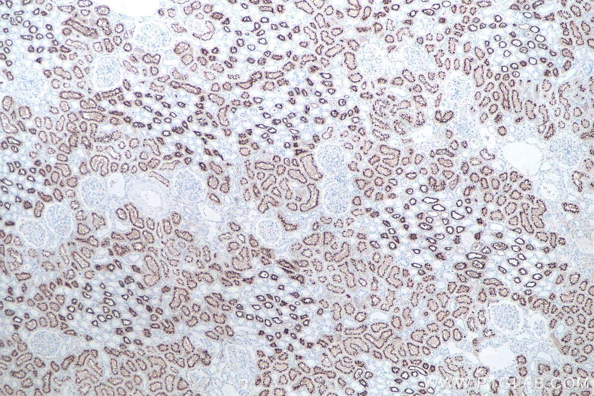 IHC staining of human kidney using 21115-1-AP Immunohistochemistry (IHC) staining of human kidney tissue using ACE2 Polyclonal antibody (21115-1-AP)