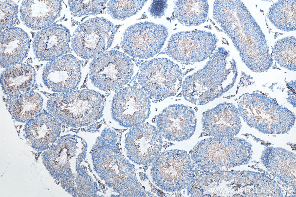 IHC staining of mouse testis using 21115-1-AP Immunohistochemistry (IHC) staining of mouse testis tissue using ACE2 Polyclonal antibody (21115-1-AP)