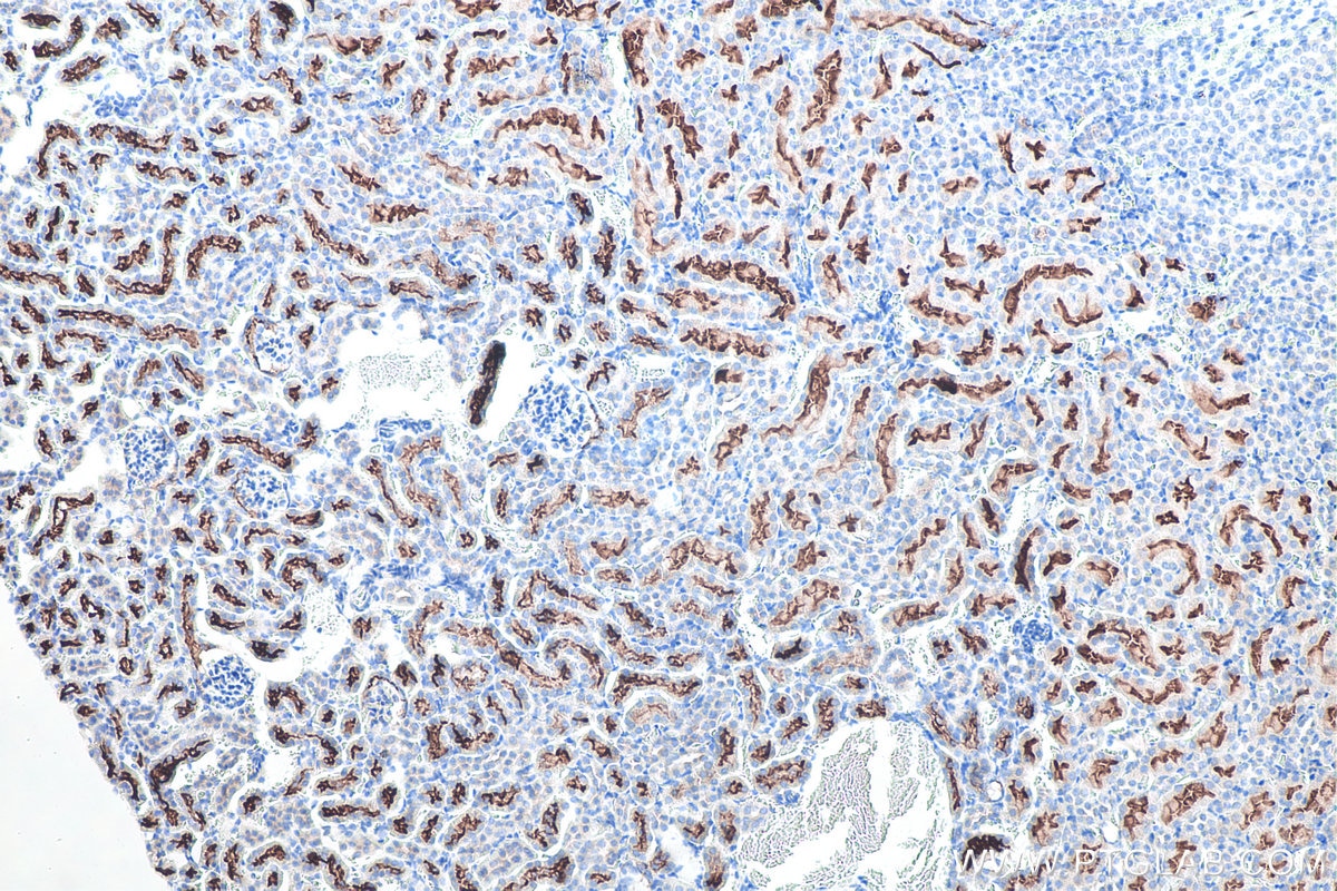 IHC staining of mouse kidney using 21115-1-AP Immunohistochemistry (IHC) staining of mouse kidney tissue using ACE2 Polyclonal antibody (21115-1-AP)
