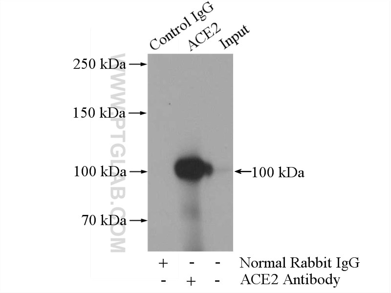 Immunoprecipitation (IP) experiment of mouse kidney tissue using ACE2 Polyclonal antibody (21115-1-AP)