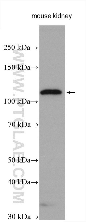 Western Blot (WB) analysis of various lysates using ACE2 Polyclonal antibody (21115-1-AP)
