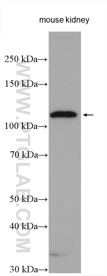 ACE2 Polyclonal antibody